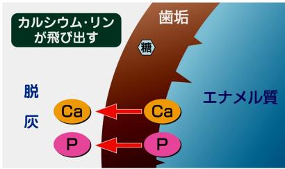 脱灰の図