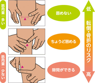 囲めない・筋肉量：多い・転倒・骨折のリスクは低／隙間ができる・筋肉量：少ない・転倒・骨折のリスクは高